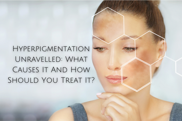 Hyperpigmentation Unravelled: What Causes It And How Should You Treat It?