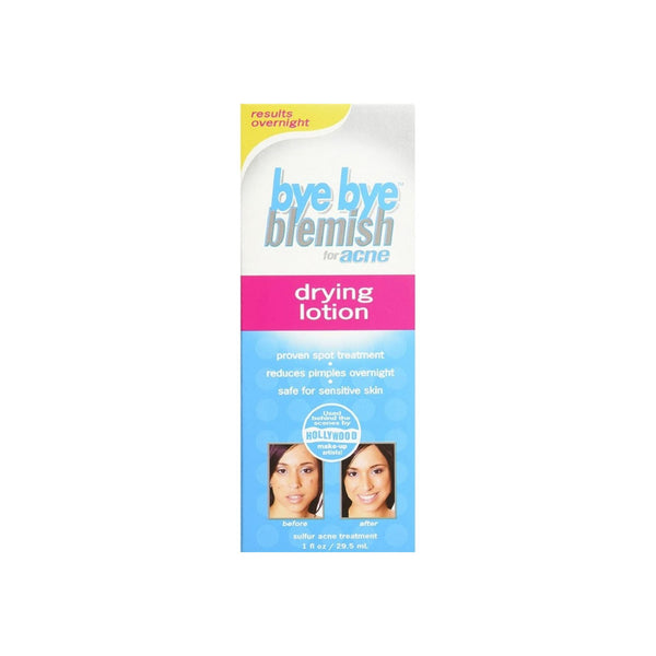 Bye Bye Blemish For Acne Drying Lotion 1 oz
