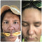Admire My Skin Dark Spot Corrector Remover for Face 1% synovea Melasma Treatment Fade Cream